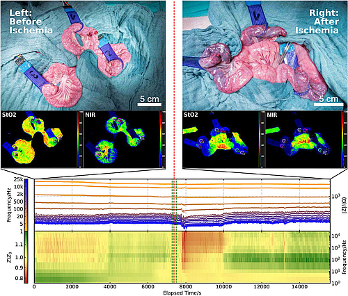 Impedanzmessung bei Ischämie