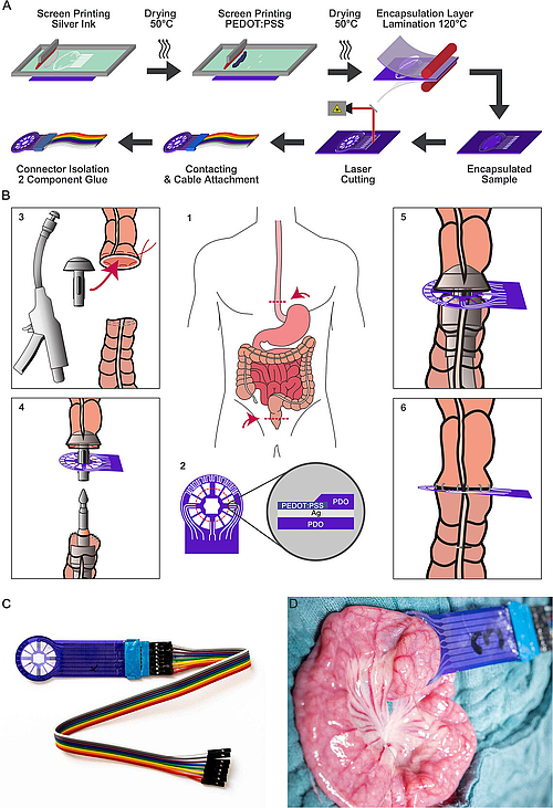 Favors Prozess Herstellung und Implantation