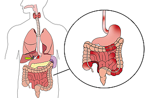 Chronisch-entzündliche Darmerkrankungen - Anatomie